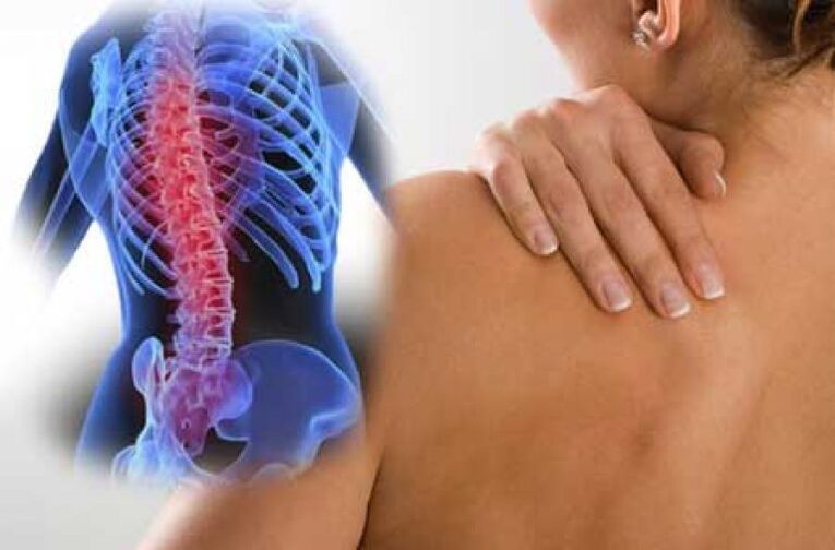 Lors d'une exacerbation d'ostéochondrose du rachis thoracique, une douleur dorsale survient