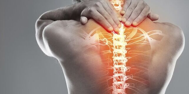 Options médicales pour la thérapie cervicale de l'ostéochondrose cervicale