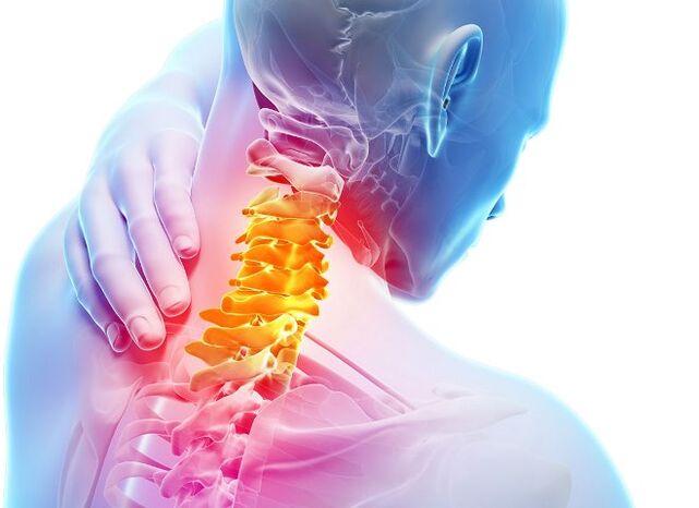 Symptômes et étapes du développement de l'ostéochondrose cervicale